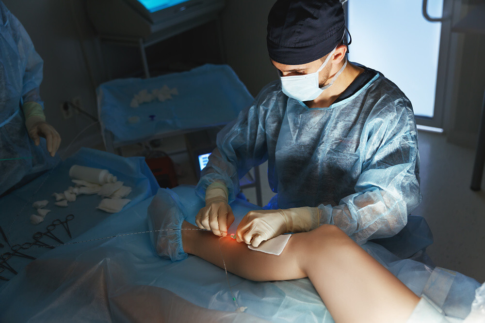 Angiología y cirugía vascular
