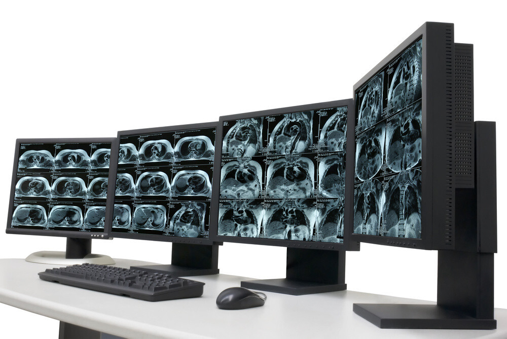 Imagenología cardiaca